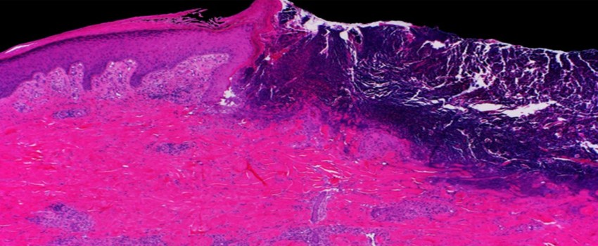 Mayo Clinic Wound Symposium: The Edges of Wound Care 2023
