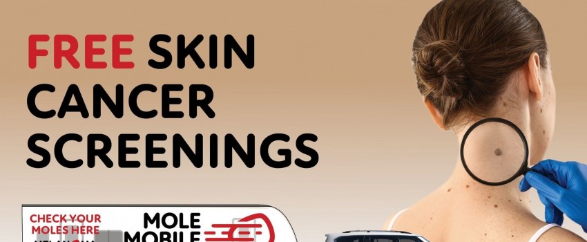 Mole Mobile - Free Skin Cancer Screenings in London