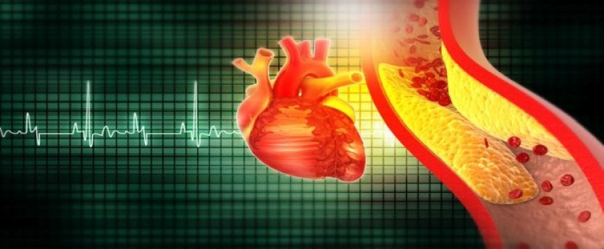 Neuroscience Heart and Stroke 2024 CNE Nursing Conference