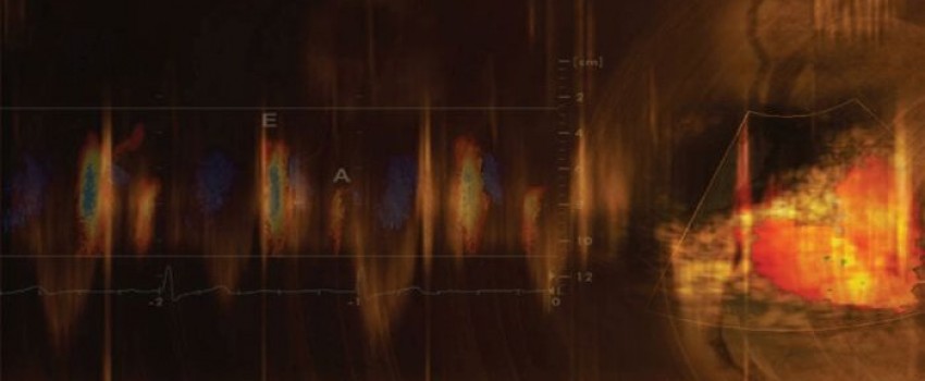 Mayo Clinic Echocardiography Board Review Course