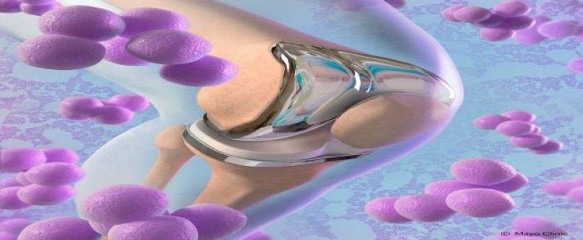 Orthopedic Infectious Diseases 2025