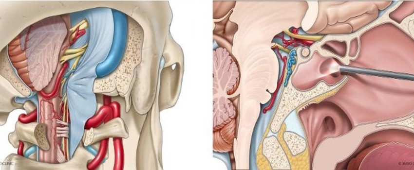 Mayo Clinic Open and Endoscopic Techniques to the Cranial Base Surgery Course 2025