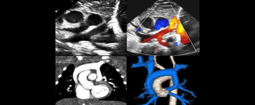Annual Morphology and Imaging in Congenital Heart Disease: The Key to Diagnosis and Management