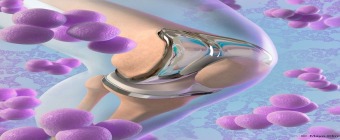 Orthopedic Infectious Diseases 2023
