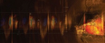Mayo Clinic Echocardiography Review Course for Boards and Recertification