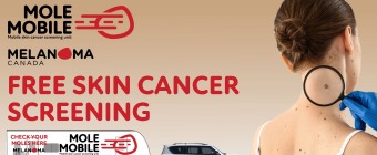 Mole Mobile - Free Skin Cancer Screenings in Mississauga