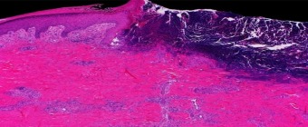 Mayo Clinic Wound Symposium: The Edges of Wound Care 2025