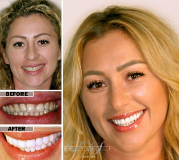 Envy Smile Dental Spa offers a discount