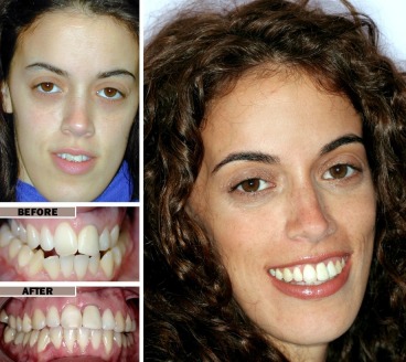 Envy Smile Dental Spa offers a discount