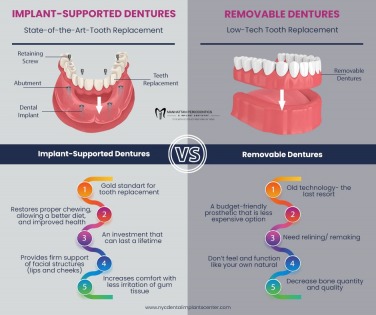 NYC Dental Implants Center offers a discount