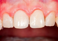  Broadway Family Dental offers a discount