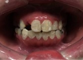 Broadway Family Dental offers a discount