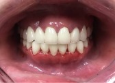  Broadway Family Dental offers a discount