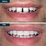 Park Avenue Smiles offers a discount