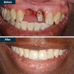 Park Avenue Smiles offers a discount