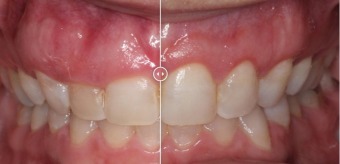 Manhattan Periodontics & Implant Dentistry offers a discount