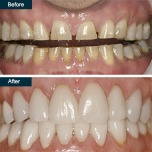 505 Dental Associates offers a discount