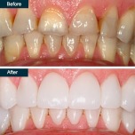 505 Dental Associates offers a discount