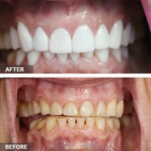 LuxDen Dental Center has a special offer for new patients.