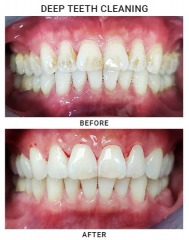 Precision Dental NYC offers a 20% discount on your first exam