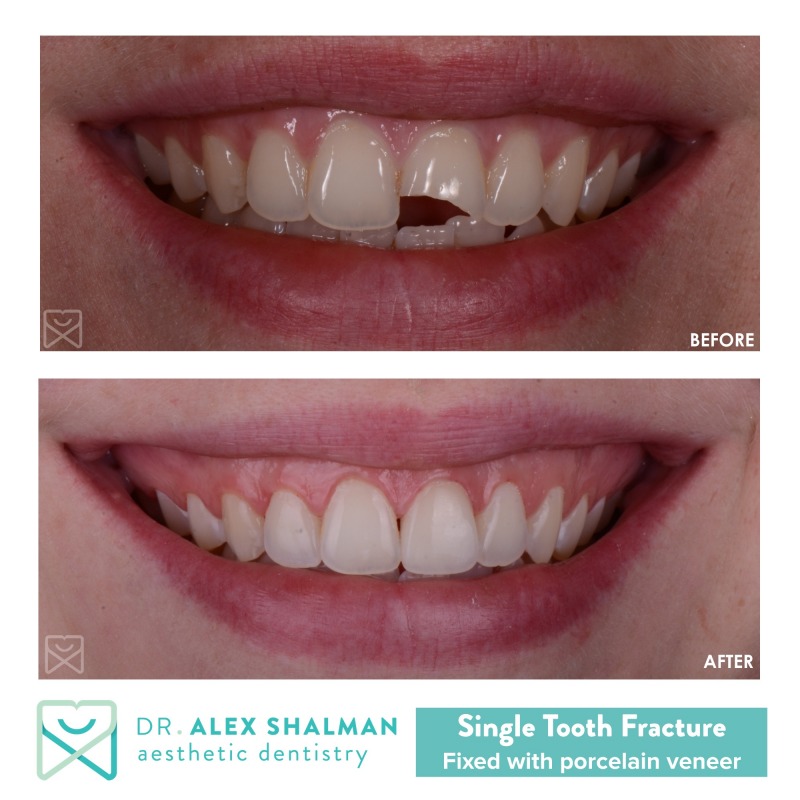 Shalman Dentistry has a special offer for new patients