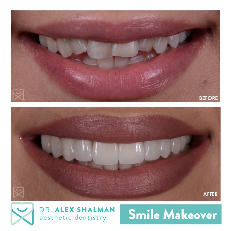 Shalman Dentistry has a special offer for new patients