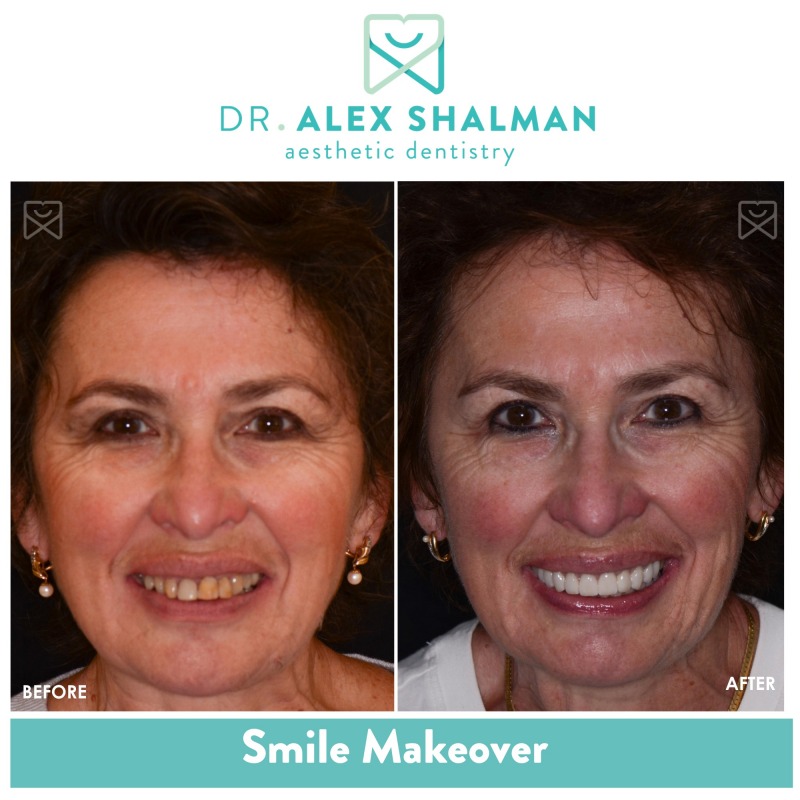 Shalman Dentistry offers a free consultation