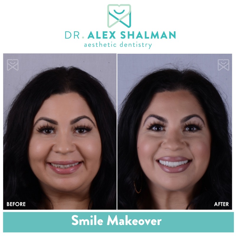 Shalman Dentistry offers a free consultation