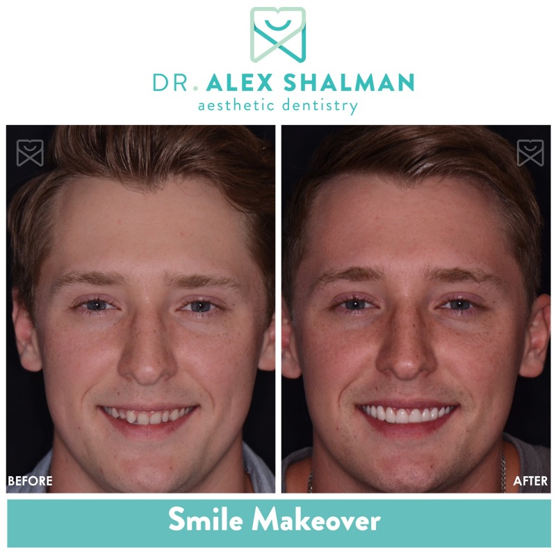 Shalman Dentistry provides dental implants