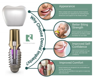 Advantages of Services in Riverside Oral Surgery