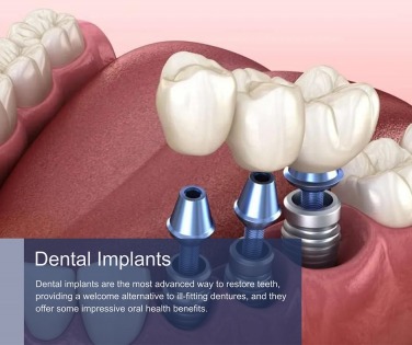 Advantages of Services in Century Dentistry Center