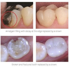 Advantages of Services in Century Dentistry Center