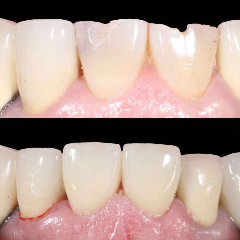 Advantages of Services in Century Dentistry Center