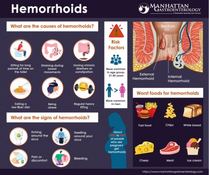 Advantages of Services in Manhattan Gastroenterology  (Upper East Side)
