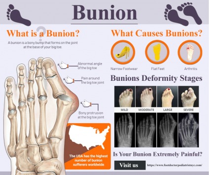 Manhattan Foot Specialists offers a discount