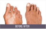 Manhattan Foot Specialists offers a discount