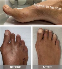 Manhattan Foot Specialists offers a discount