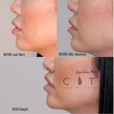 Advantages of Services in City Facial Plastics