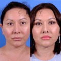 Advantages of Services in City Facial Plastics