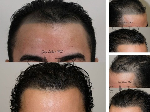 Advantages of Services in City Facial Plastics