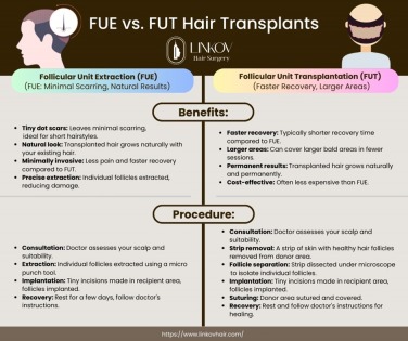 Advantages of Services in Linkov Hair Surgery