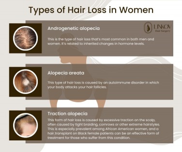 Advantages of Services in Linkov Hair Surgery