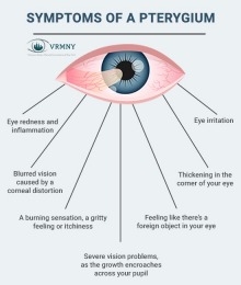 Advantages of Services in Vitreous Retina Macula Consultants of New York