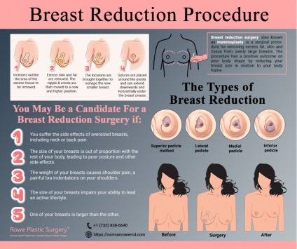 Advantages of Services in Rowe Plastic Surgery