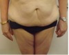 Advantages of Services in Rowe Plastic Surgery