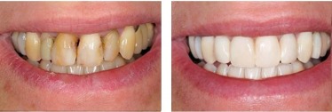 Advantages of Services in My New Jersey Dentist