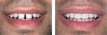 Advantages of Services in My New Jersey Dentist