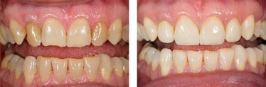 Advantages of Services in My New Jersey Dentist