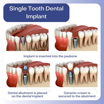 Advantages of Services in My New Jersey Dentist