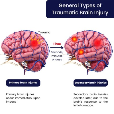 Advantages of Services in Neuro Injury Specialists